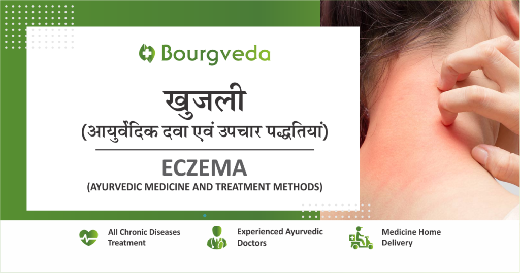 Ayurvedic medicine and treatment for Eczema