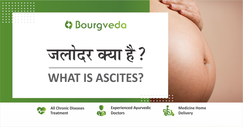 What is ascites
